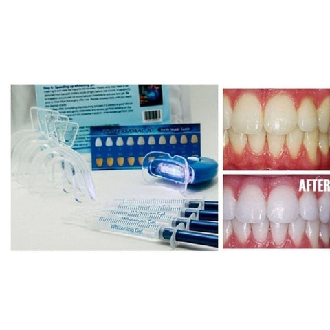 Home Teeth Whitening 3D System and Free Remineralization Gel