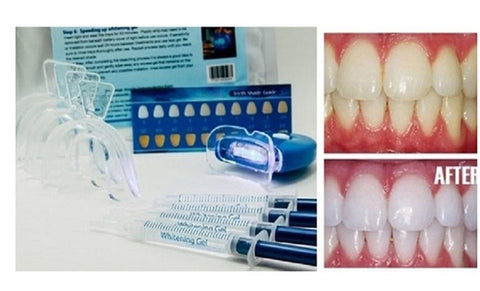 Home Teeth Whitening 3D System and Free Remineralization Gel