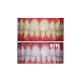 Home Teeth Whitening 3D System and Free Remineralization Gel
