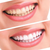 Home Teeth Whitening 3D System and Free Remineralization Gel
