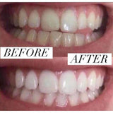 Professional Home 3D Teeth Whitening Strips